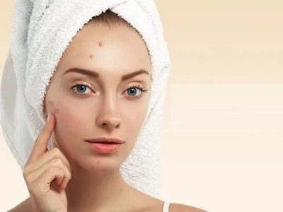 How hyaluronic acid helps for acne? 3 beauty tips for you