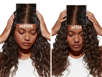 Ultimate Guide to Effective Damaged Hair Treatment: Restore Your Locks Today!