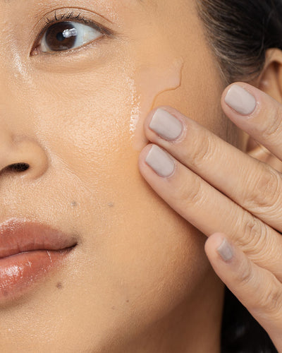 Close-up of a person applying an acne treatment lotion on their face, showcasing smooth skin and effective skincare.